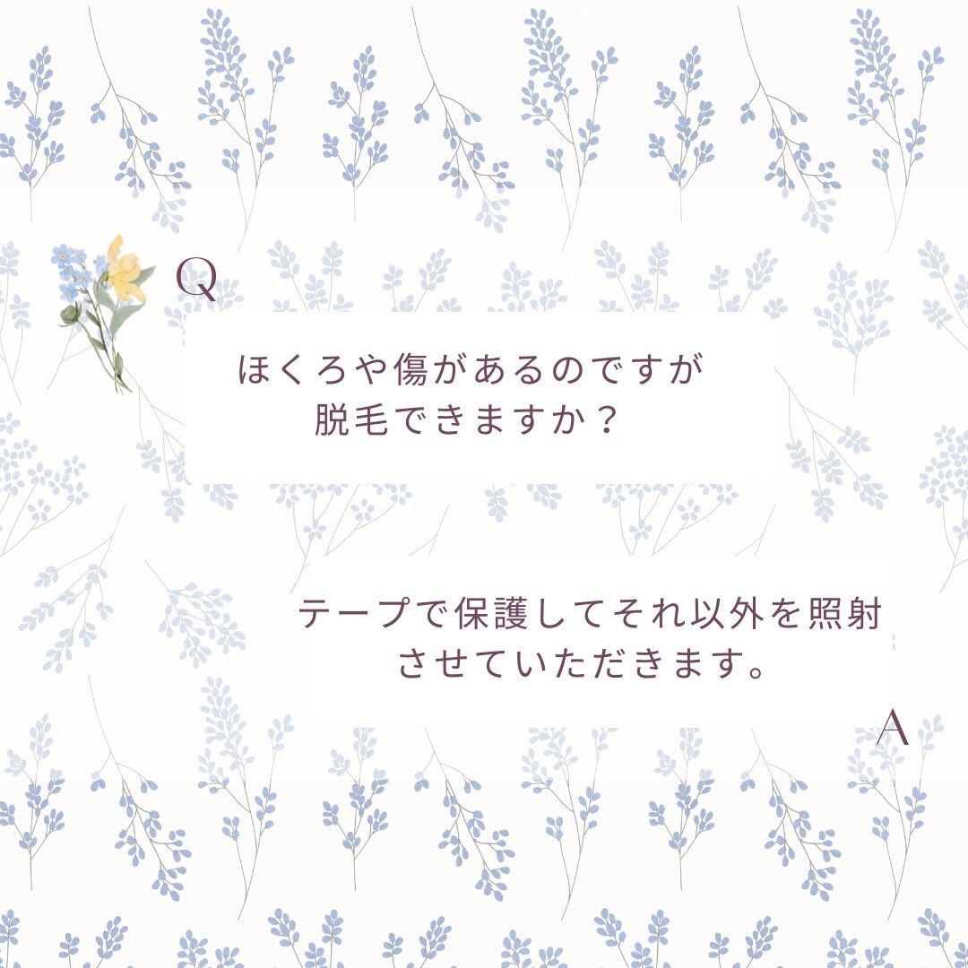 脱毛前の良くあるQ&Aをまとめました☺️☝🏻