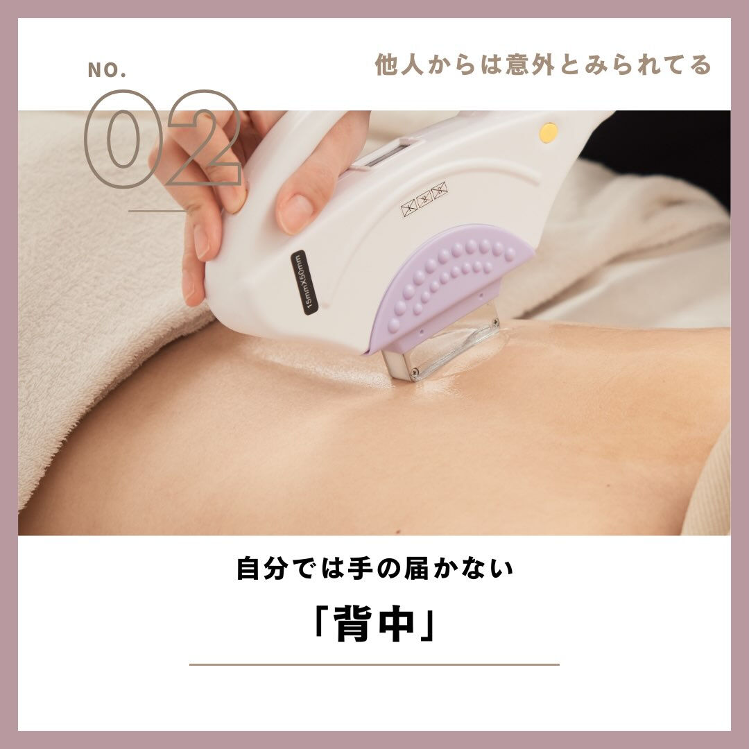 ＼みんなはどこから脱毛してる？👀／