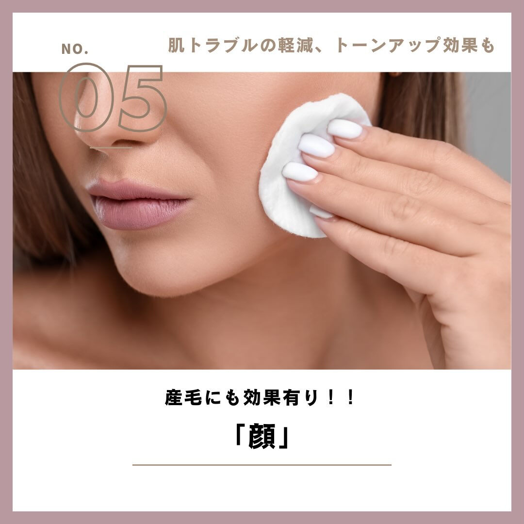 ＼みんなはどこから脱毛してる？👀／